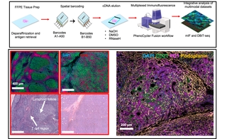 Histology and fluorescence image of tumors