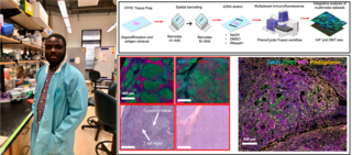 Left: Archie in the lab; Right: Fluorescence image of cancer tissue Archie analyzes in his research