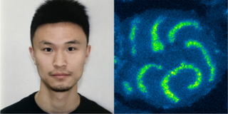 Headshot of XJ Xu (left) fluorescence microscopy image (right)