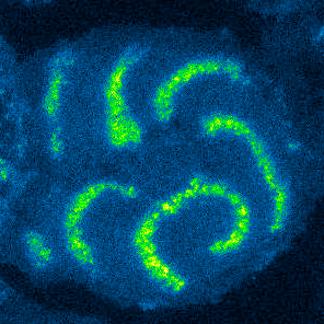 Fluorescence imaging of FBP17 waves on mast cell plasma membranes